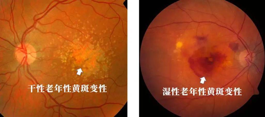 人临死前视网膜上留下的图像这个说法对吗?