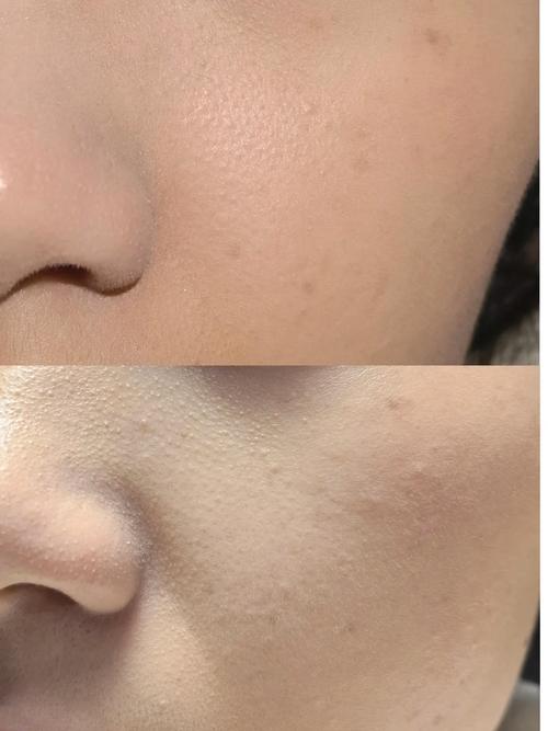 照相打光和不打光区别是什么图2