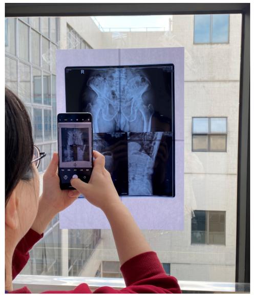 在翻拍照片时,怎样避拍出的照片上有白点?