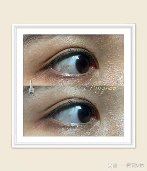 拍照眼睛反光怎么p掉