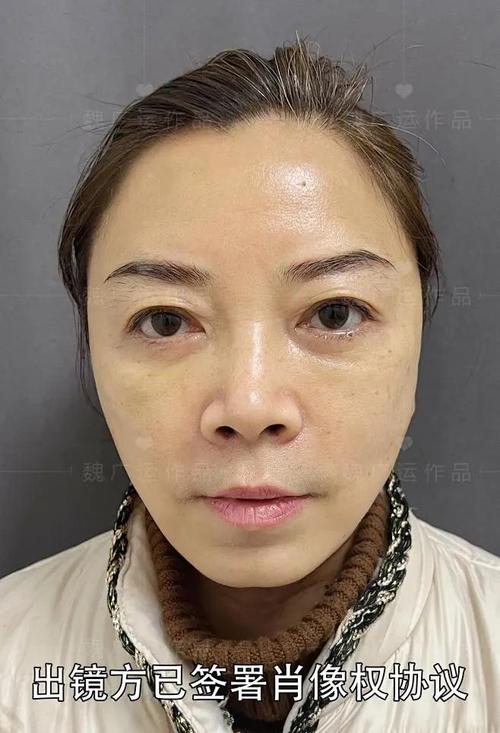 死亡灯光照片图2