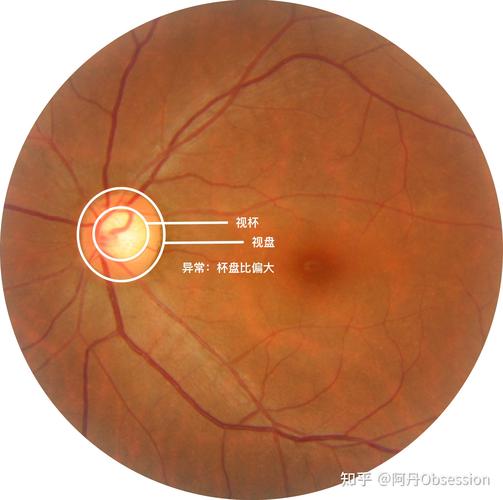 眼底照相机的使用方法图2