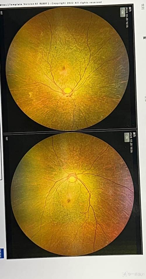 眼底照相机的使用方法图3