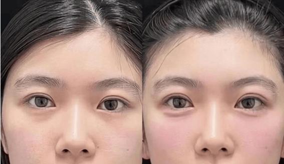 拥有卧蚕很好看,自己怎样才能拥有呢?