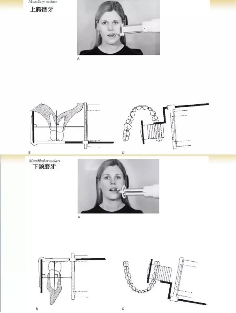 如何拍摄小牙片ppt