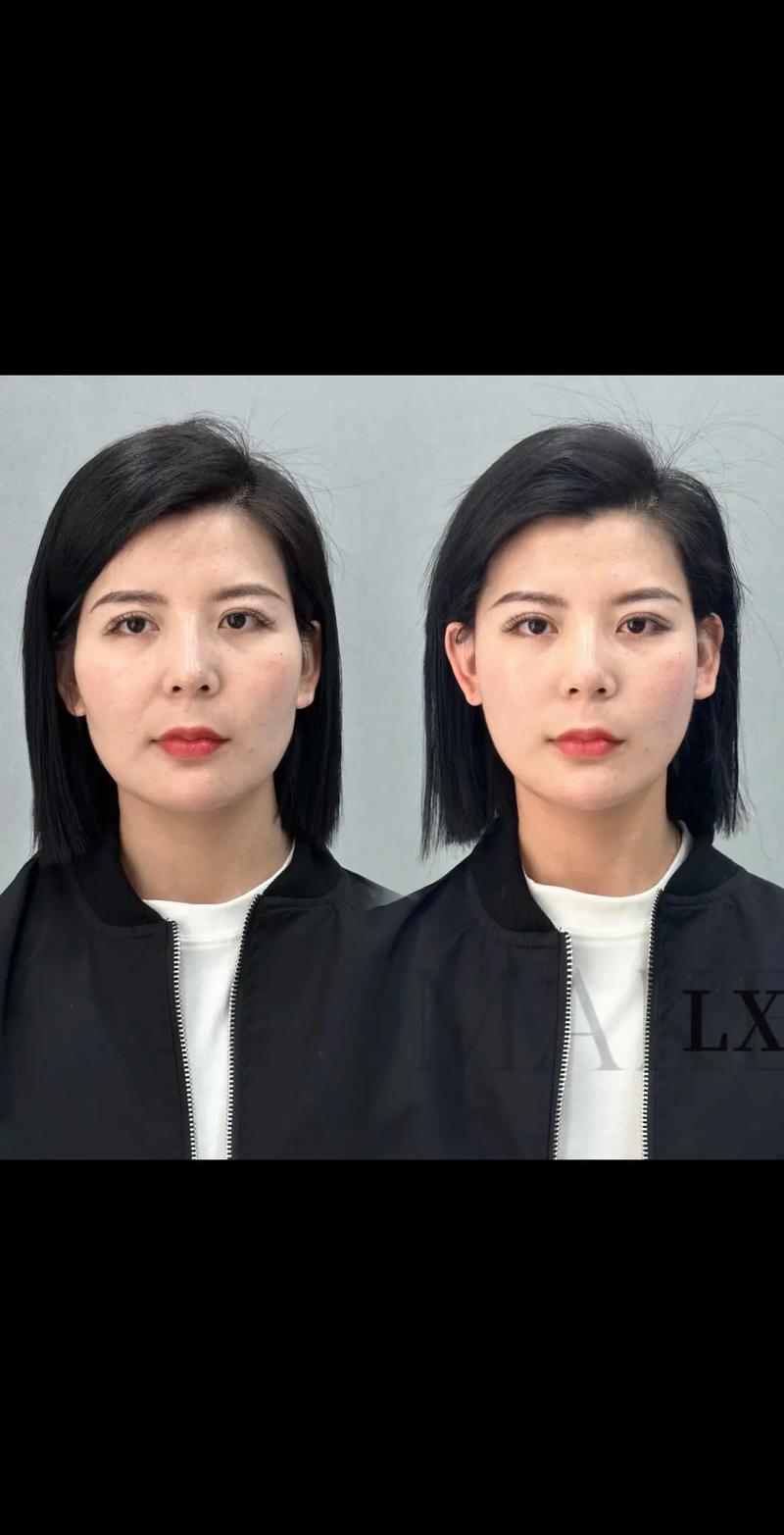 医美拍照角度示范图片大全图3