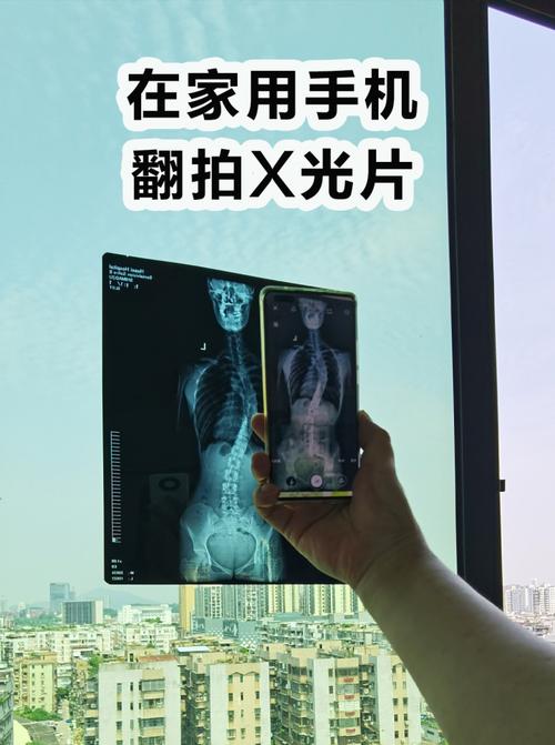 苹果手机翻拍照片怎样才能拍清晰