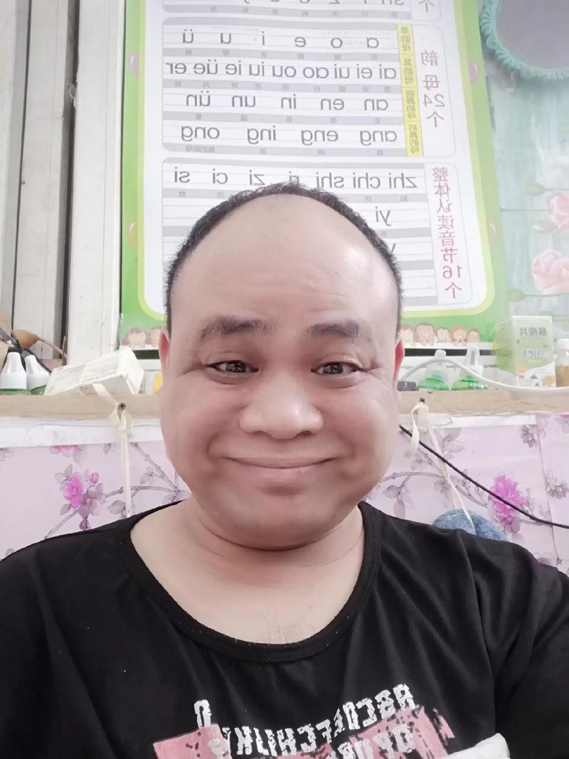 哪个角度自拍最丑图3