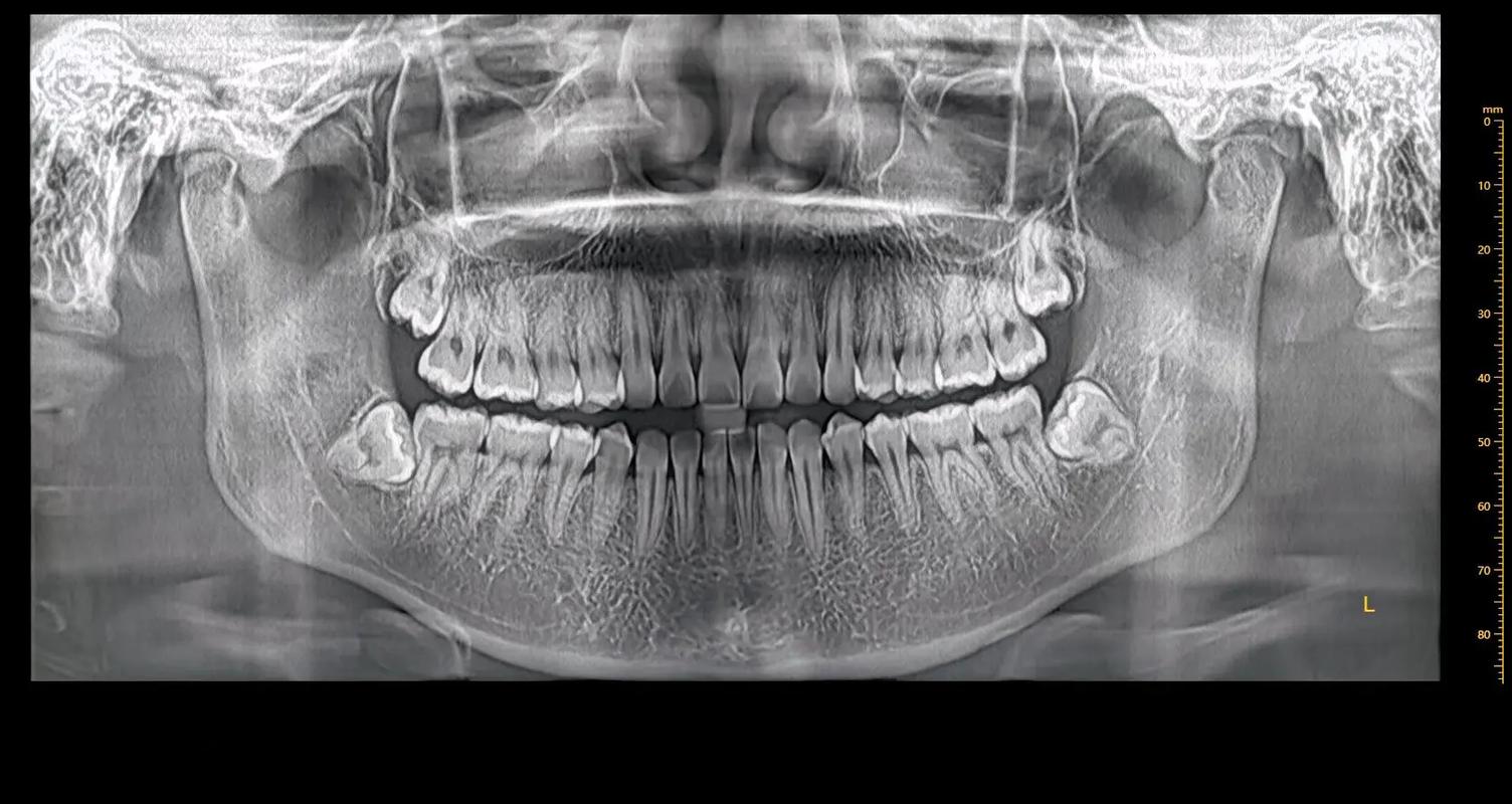 口腔影像总结(绝对清晰)