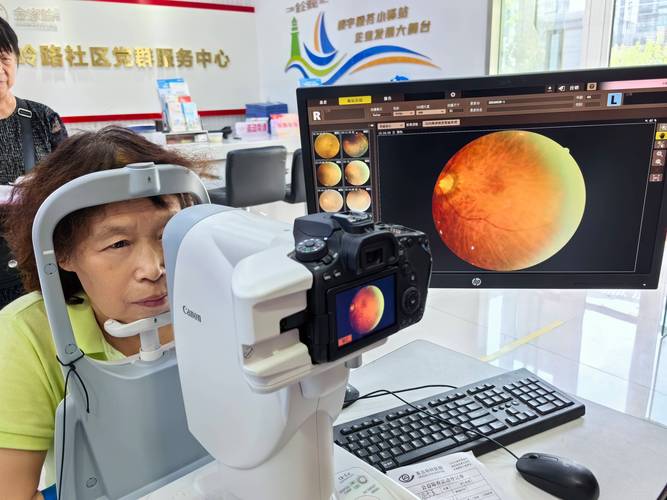 眼底照相机图片分析图2