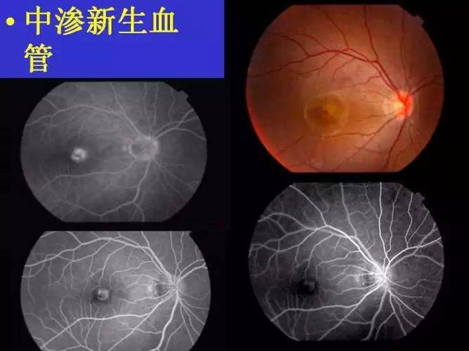 眼底照相机图片分析图3