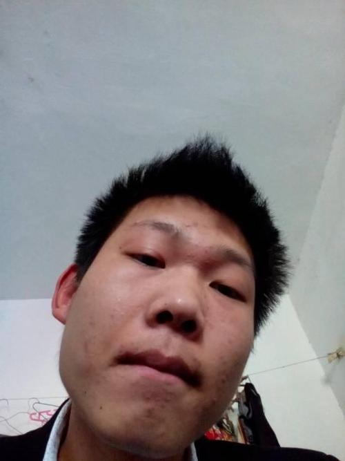 拍照角度不同,结果截然不同图3